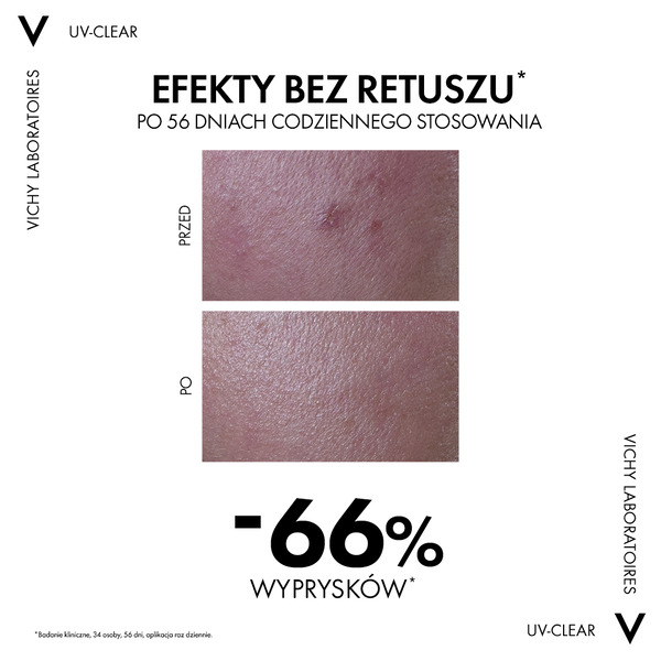 Vichy Capital Soleil, fluid przeciw niedoskonałościom, SPF 50+, 40 ml