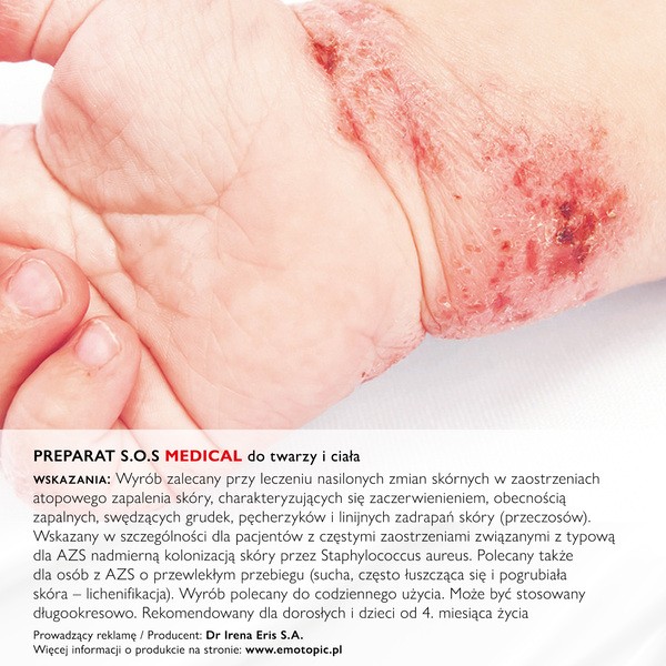 Emotopic Bacteria Control, preparat S.O.S. Medical, do twarzy i ciała, 30 ml