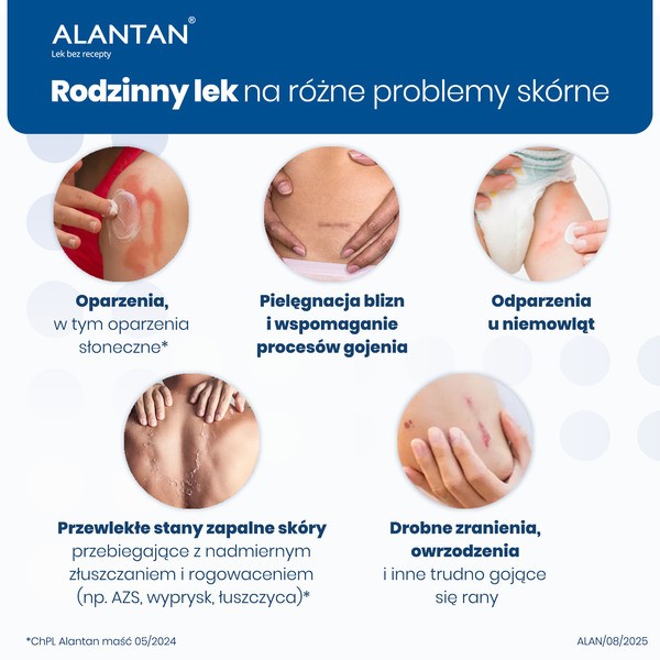 Alantan, 20 mg/g, maść, 100 g