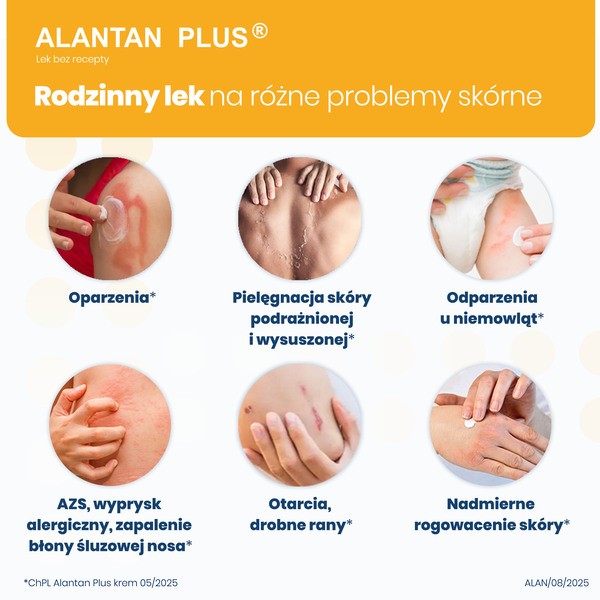 Alantan Plus, (20 mg+50 mg/g), krem, 35 g