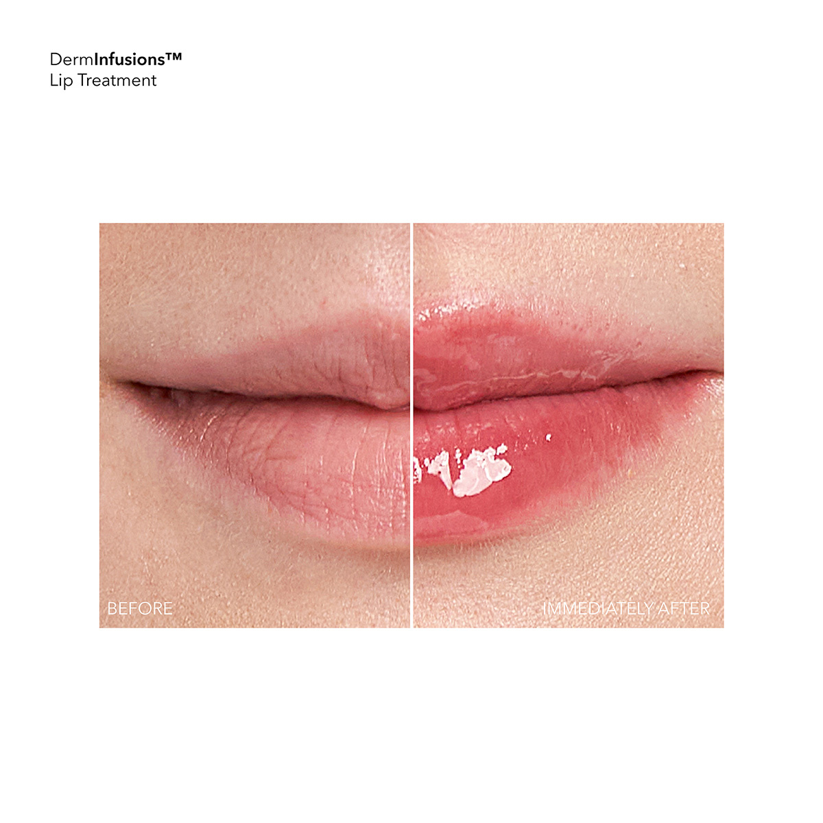 Dr Dennis Gross DermInfusions™ Plump   Repair lip Treatment (10 ml)